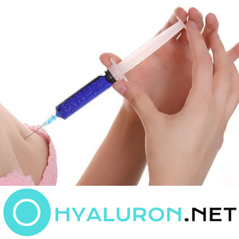 Hyaluronsäure Brust Gesamt