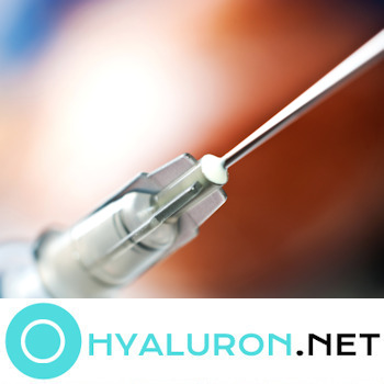 Hyaluronspritzen Detail